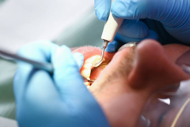 Best Emergency Dental Extractions in West Baraboo, WI