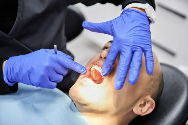 Best Broken or Cracked Tooth Emergency Dentist in West Baraboo, WI